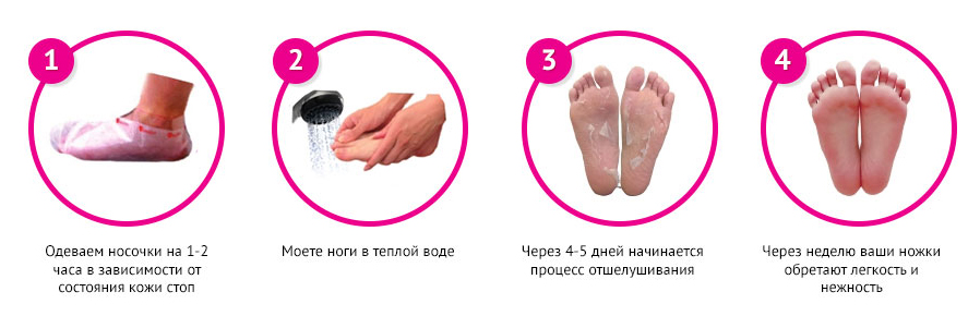 педикюрные носочки sosu