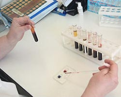 Показатели глюкозы в крови